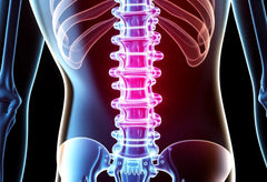 Tehokkaat harjoitukset L5/S1-välilevyn pullistuman helpottamiseen
