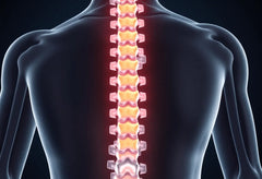 Elämä uuden selän kanssa: toipumisen mahdollisuudet ja haasteet