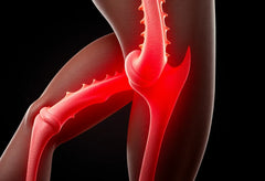 Kivun voittaminen: avaimet takareiden ja polvitaipeen vaivoihin