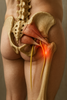 Kivun selättäminen: piriformis-syndrooman hoito ja helpotus