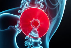 Say goodbye to herniated disc pain